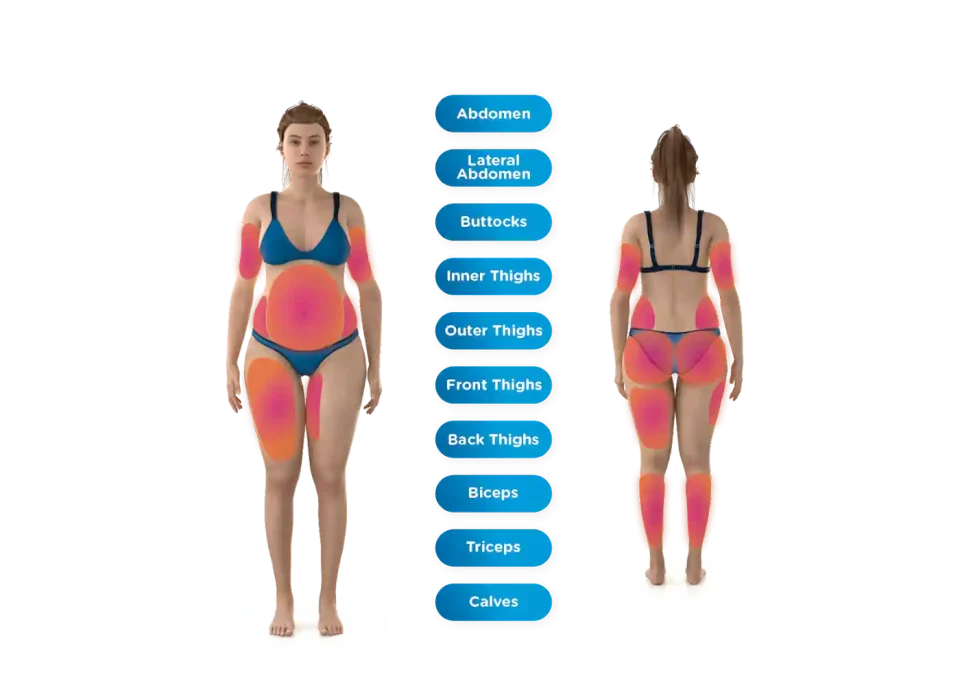 emsculpt neo treatment areas graphics